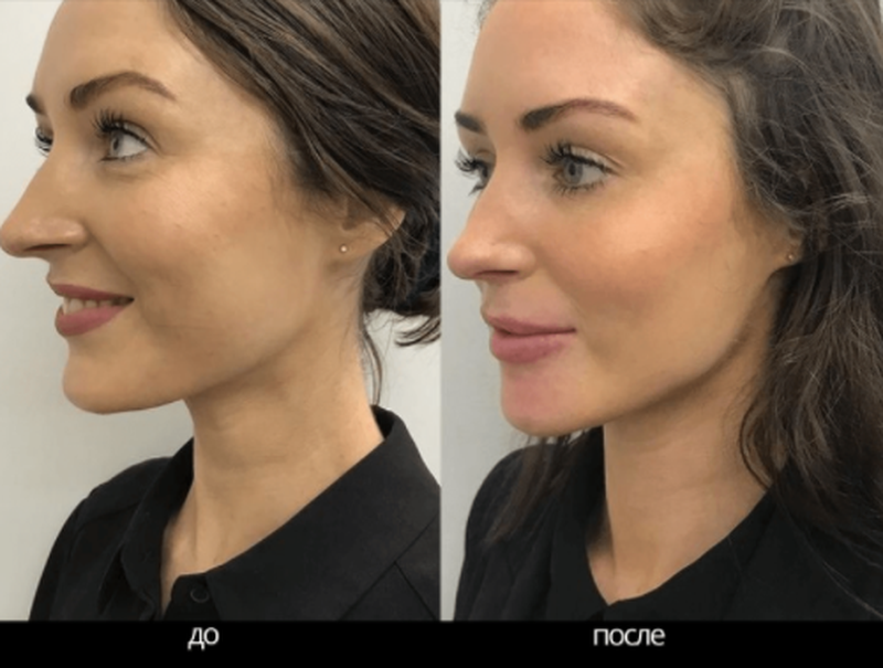 Тренажер Для Скул, Лица, Подбородка, Эспандер Для Скул