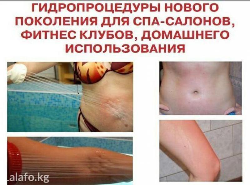 Душ алексеева до и после фото